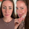 Lip Booster Kit