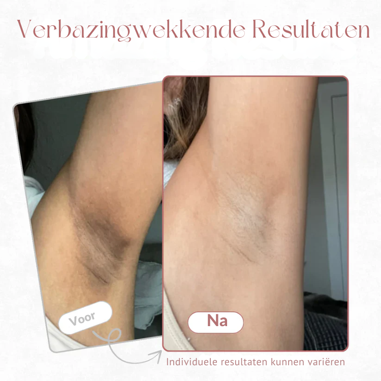 BrightSkin™ Turmeric + Kojic Body Peel Spray