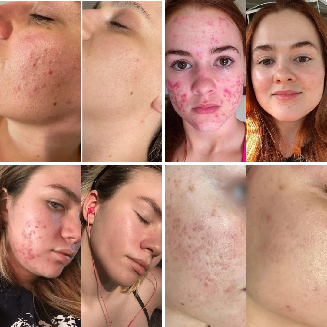 DermalReset™ 345 Beschermende Crème