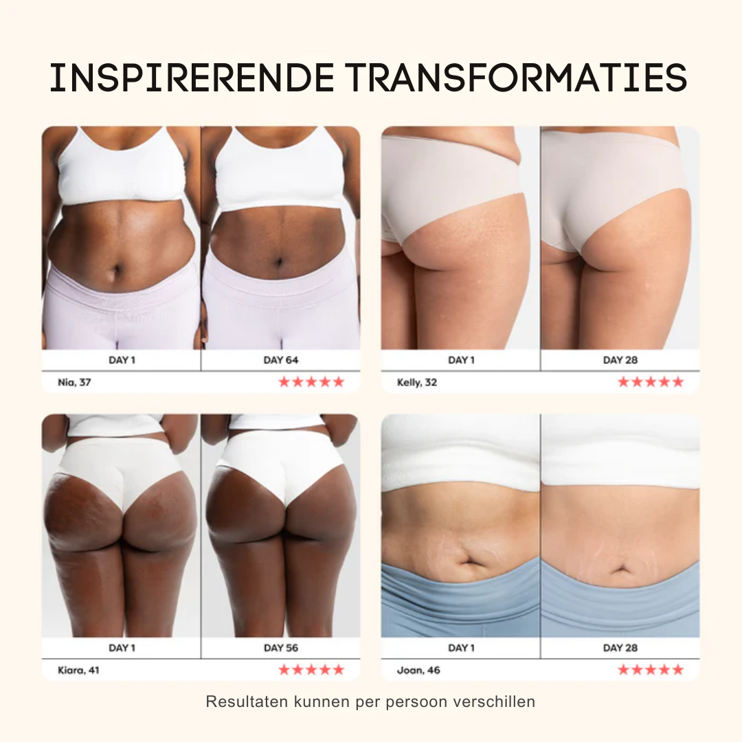 ReduSculpt™ Lichaamsverstevigingsapparaat