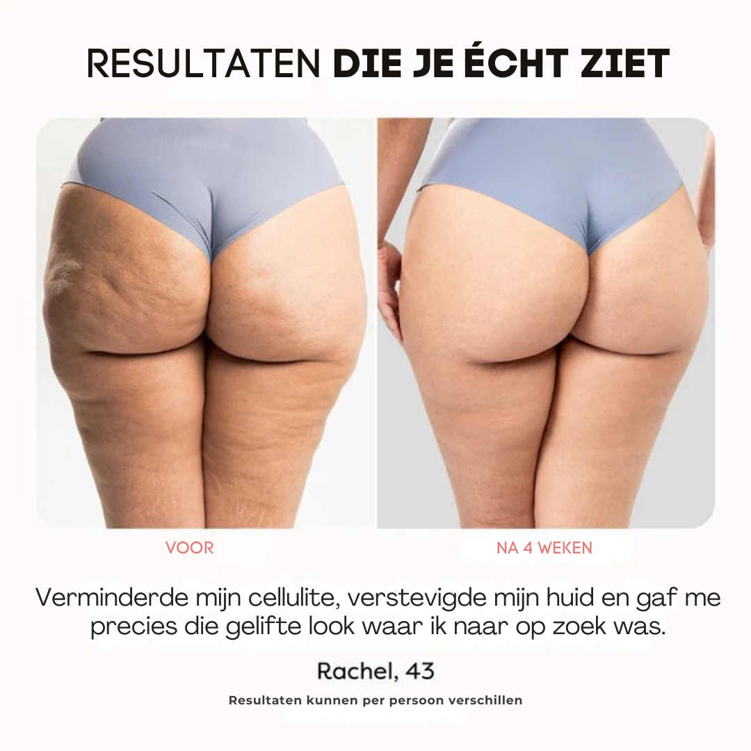 ReduSculpt™ Lichaamsverstevigingsapparaat