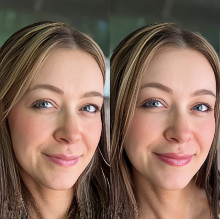 Lip Booster Kit