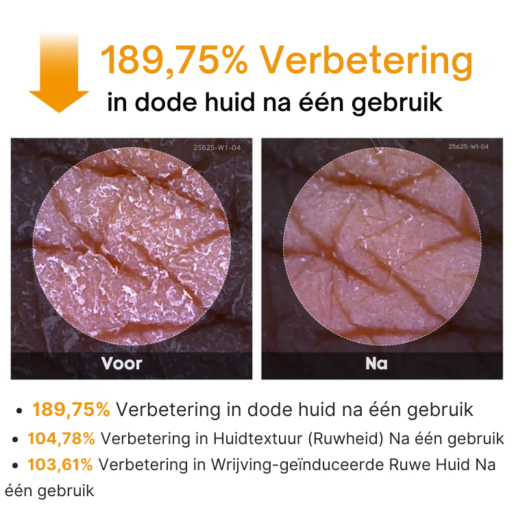 BrightSkin™ Turmeric + Kojic Body Peel Spray