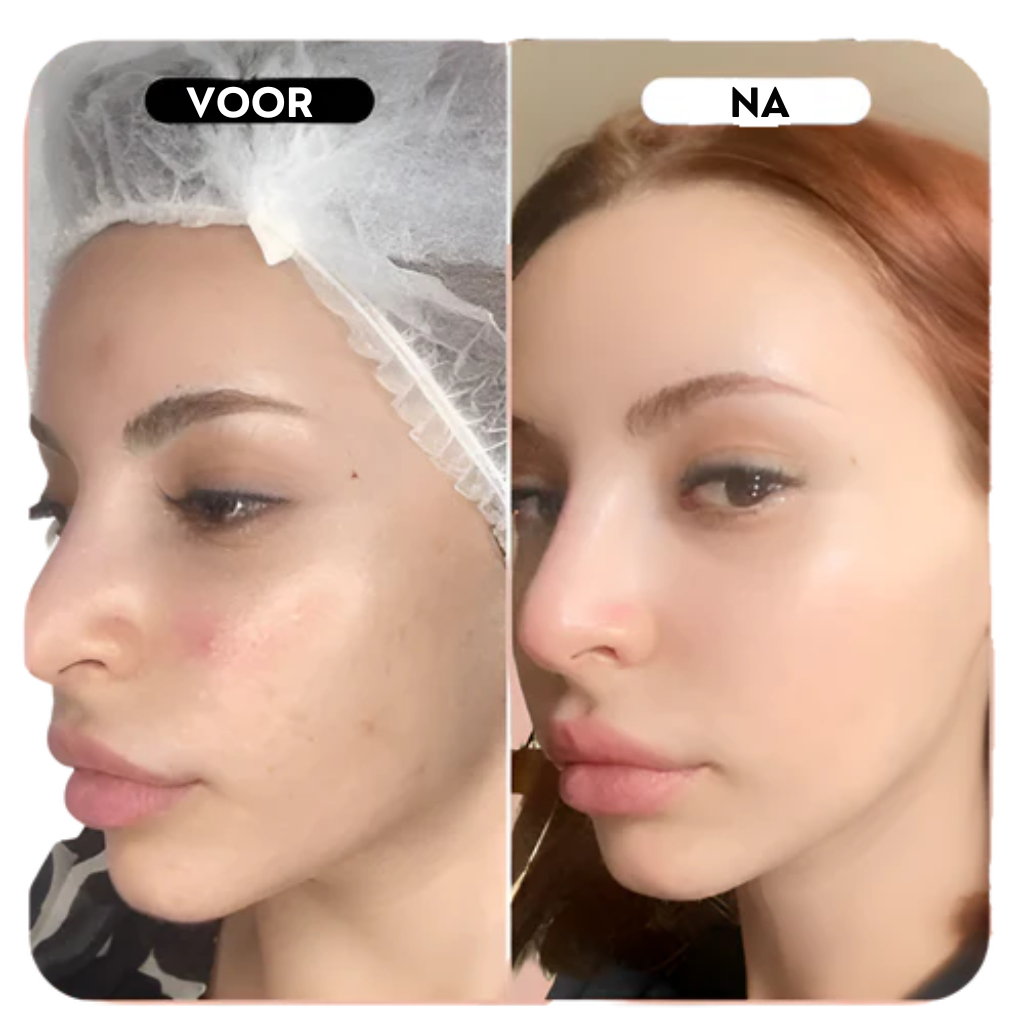Luna Glow - Collageen nacht masker