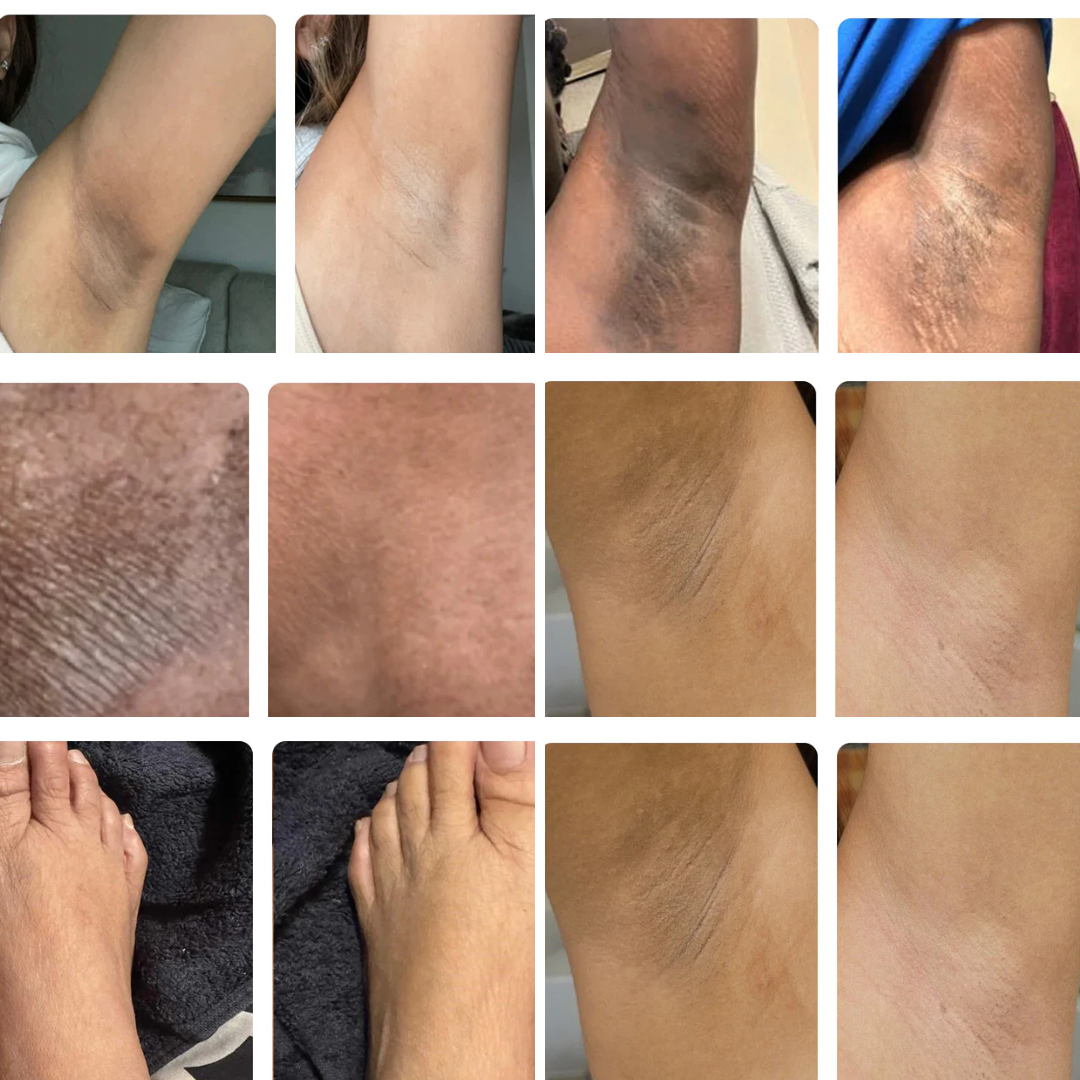 BrightSkin™ Turmeric + Kojic Body Peel Spray