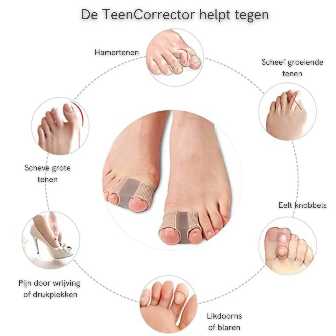 Overzicht van voetsituaties waarbij de TeenCorrector gedragen wordt