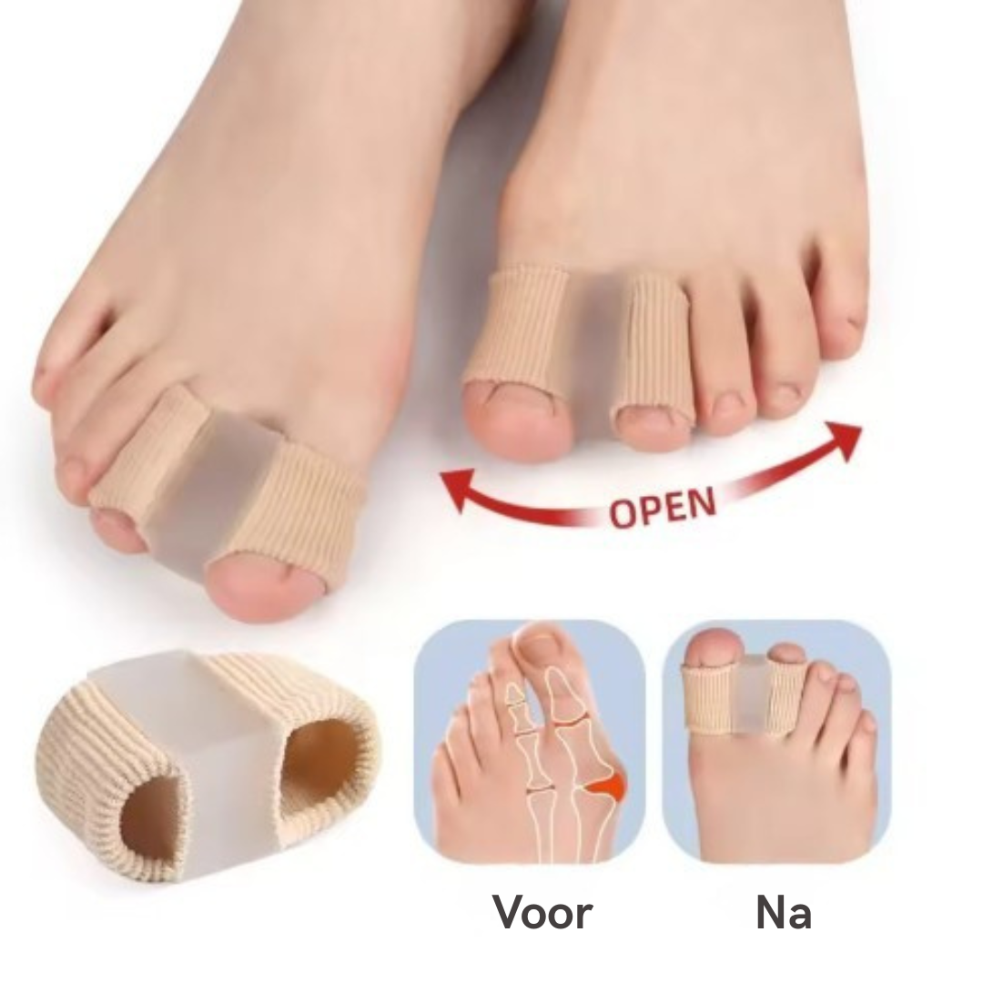 Zo open je de TeenCorrector en schuif je hem om je grote teen
