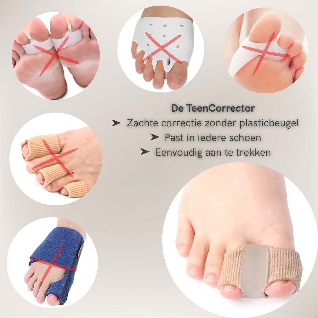 TeenCorrector vergeleken met andere teenspreiders