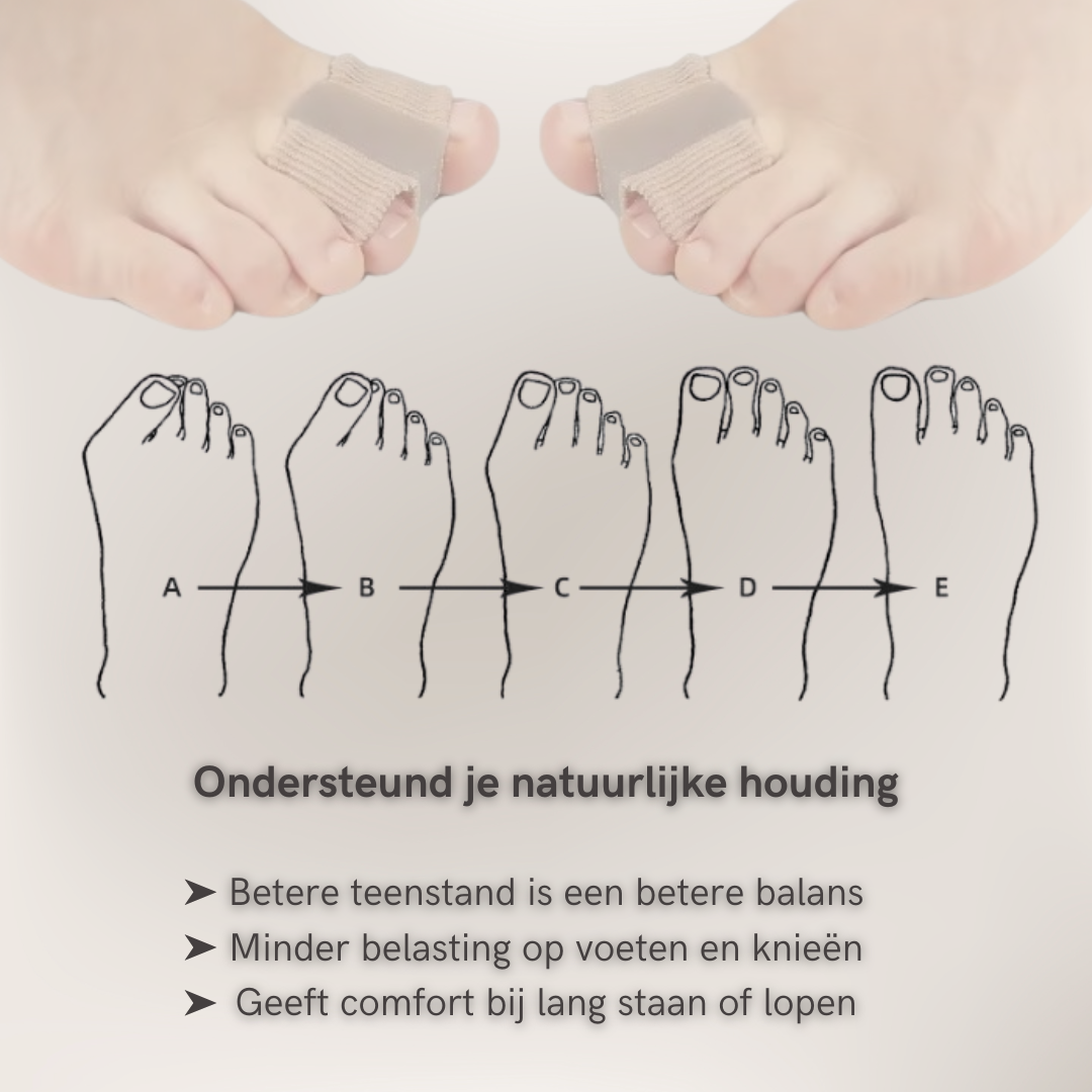 Illustratie van de teenstand met de TeenCorrector teenspreider